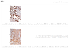 K106675PAnti-SLC10A1 Polyclonal Antibody